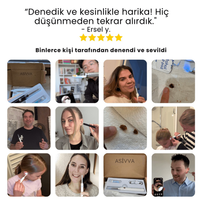 Asivva Kameralı Kulak Temizleme Cihazı
