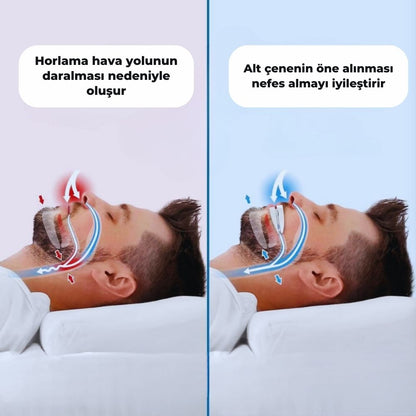 Asivva Horlama Karşıtı Uyku Ağızlığı