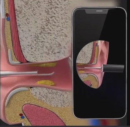 Asivva Kameralı Kulak Temizleme Cihazı